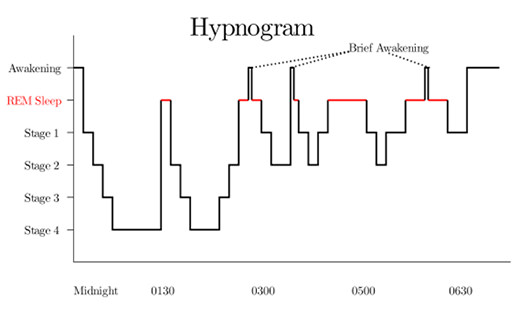 Hypnogram